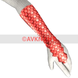 Nova+ Coral Scale Gloves